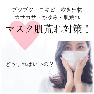 マスクによる肌荒れ、どうすればいい?スキンケア対策