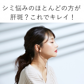 シミ悩みのほとんどの方が 肝斑?これでキレイ!